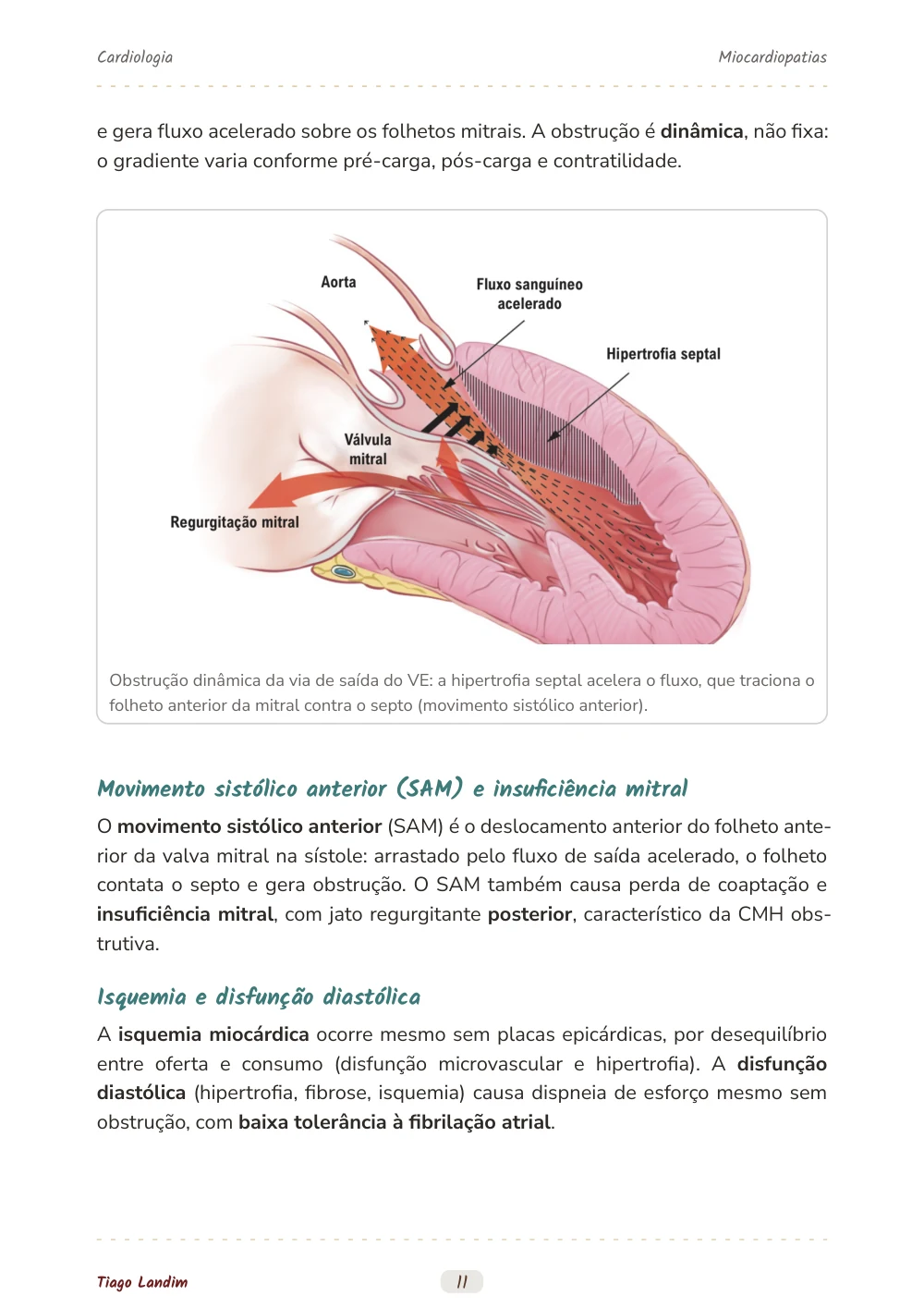 Miocardiopatias