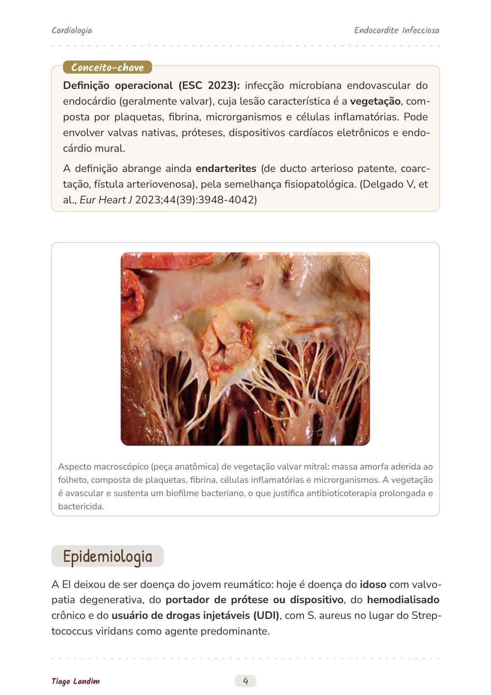 Endocardite Infecciosa