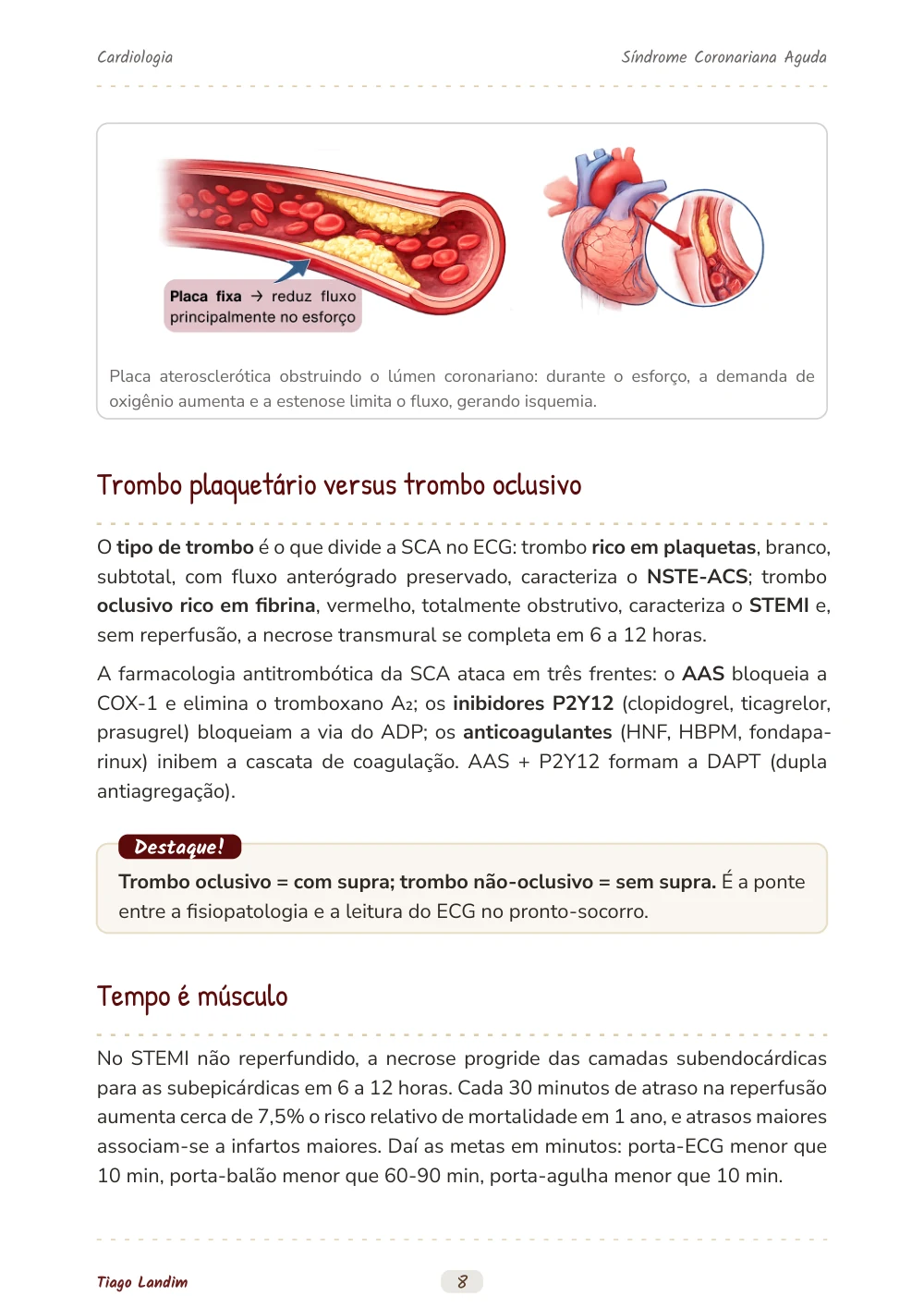 Síndrome Coronariana Aguda