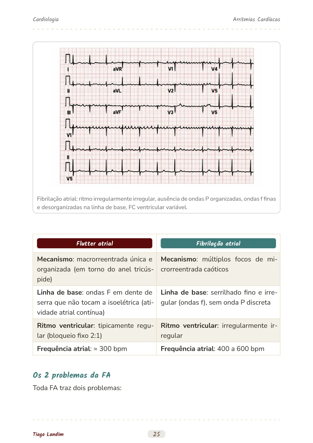 Arritmias Cardíacas