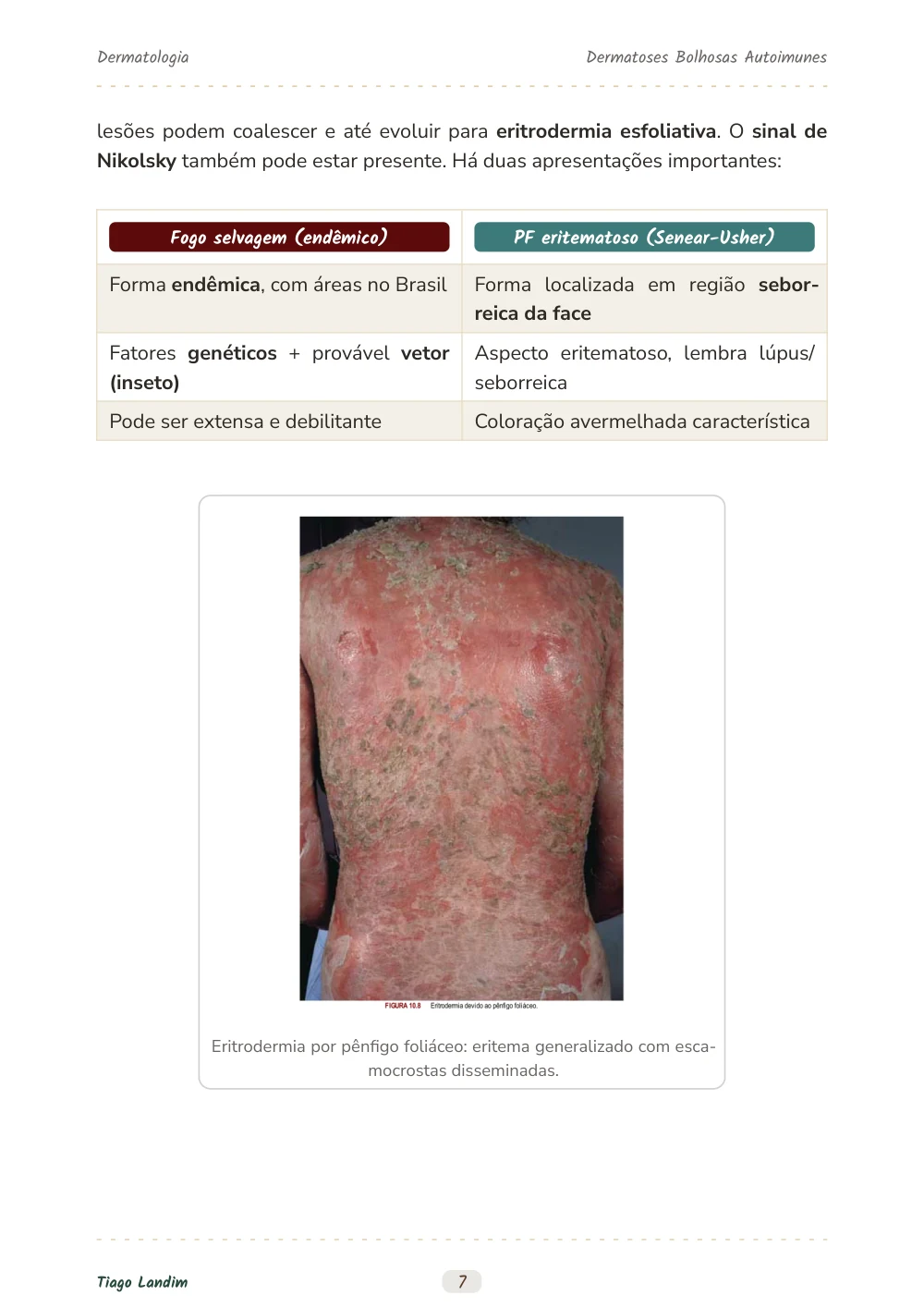 Dermatoses Bolhosas Autoimunes