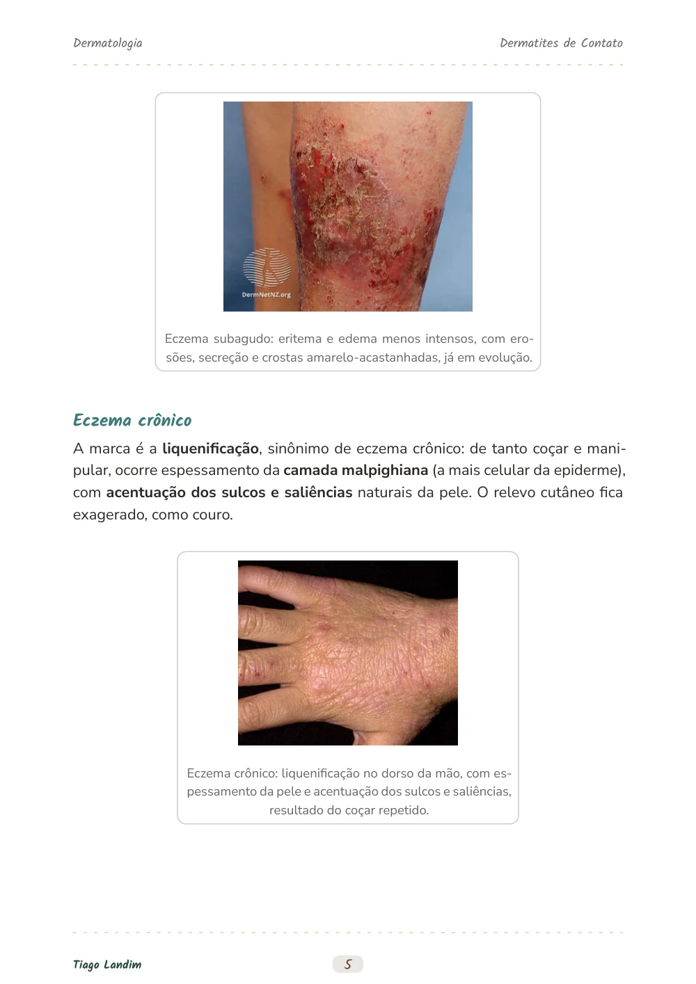 Dermatites de Contato