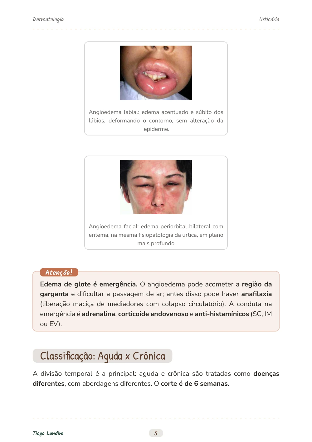 Urticária
