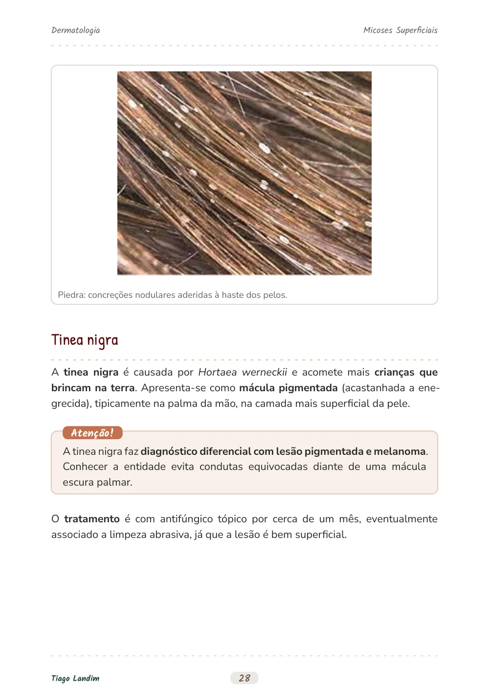Micoses Superficiais