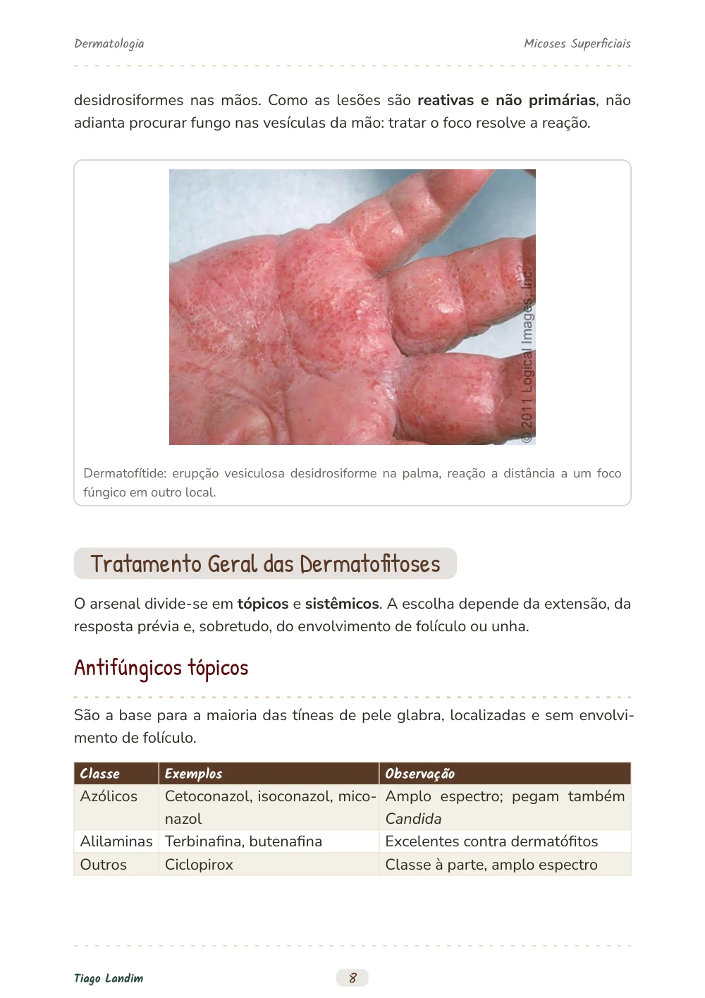 Micoses Superficiais