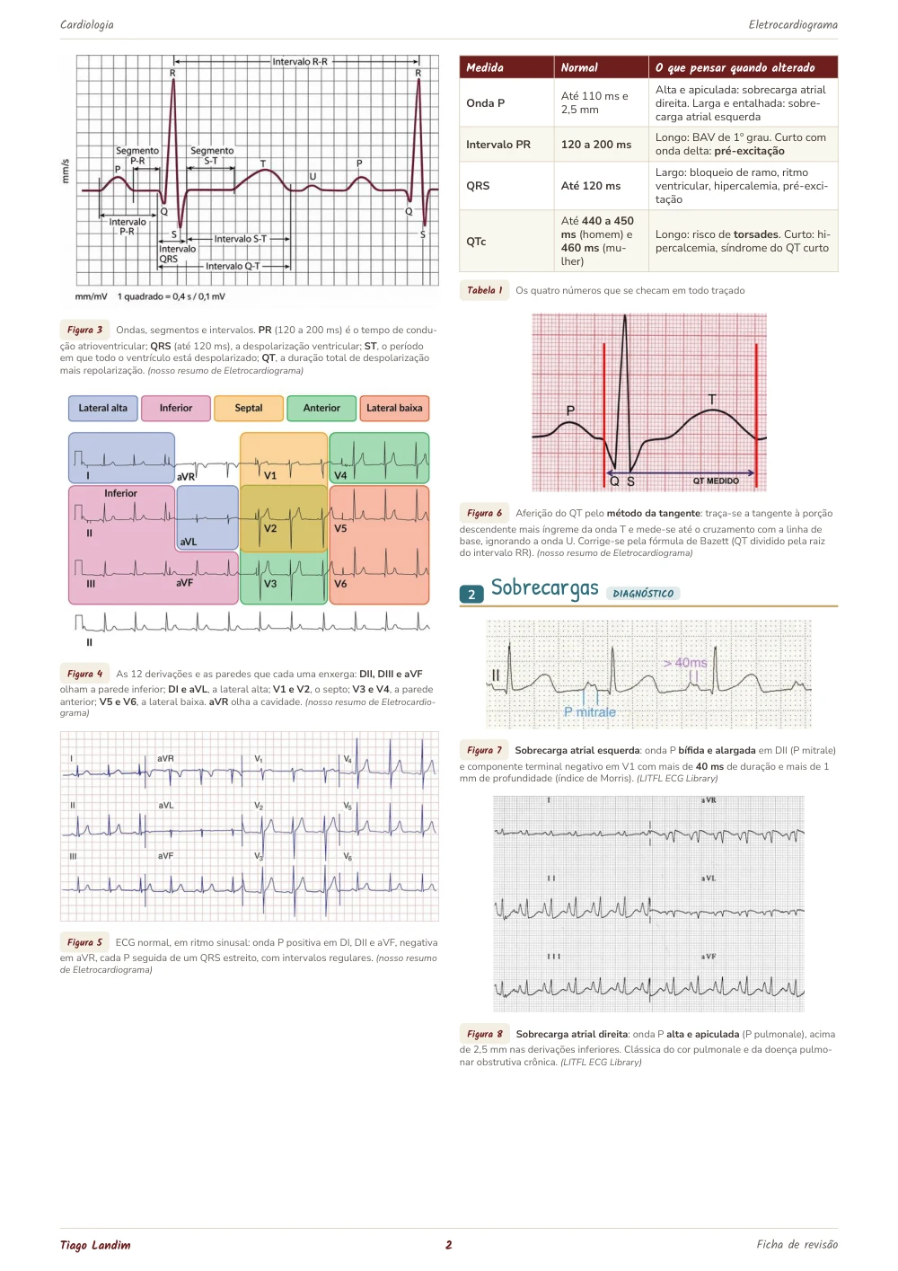 Amostra das fichas-resumo com imagens de ECG