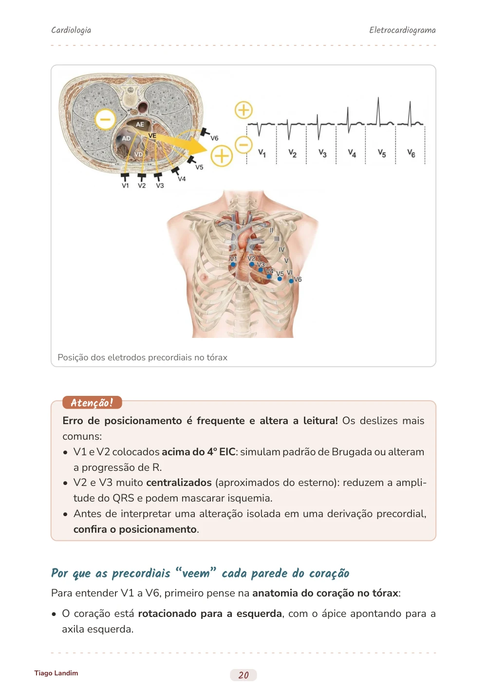 Eletrocardiograma