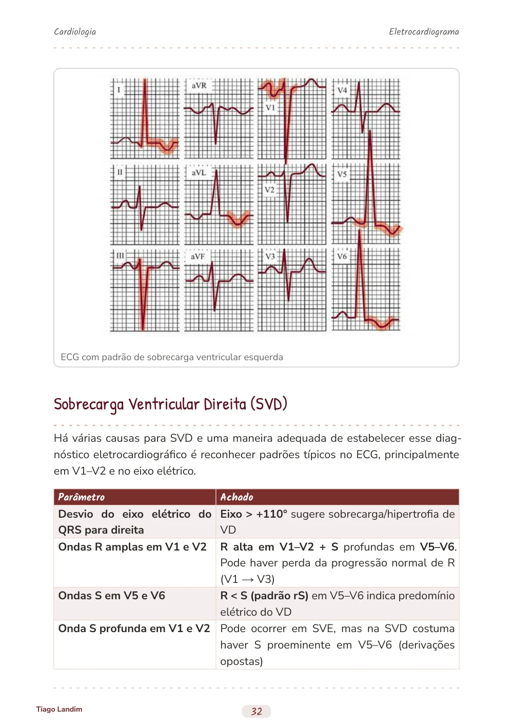 Eletrocardiograma