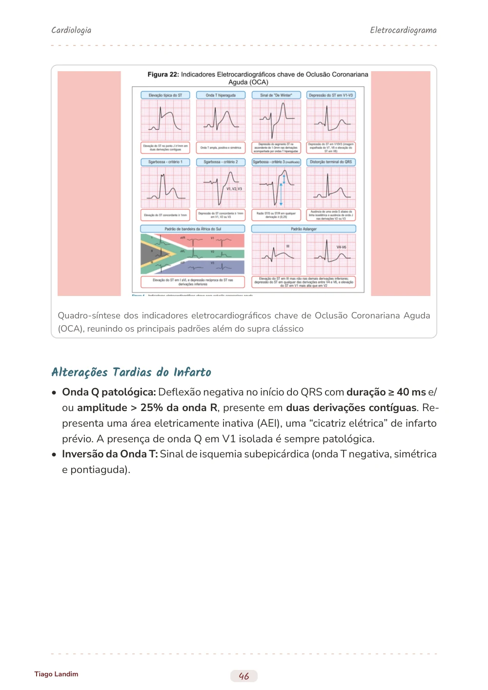 Eletrocardiograma