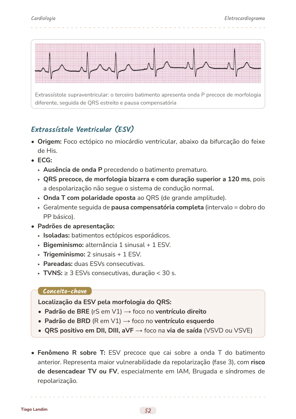 Eletrocardiograma