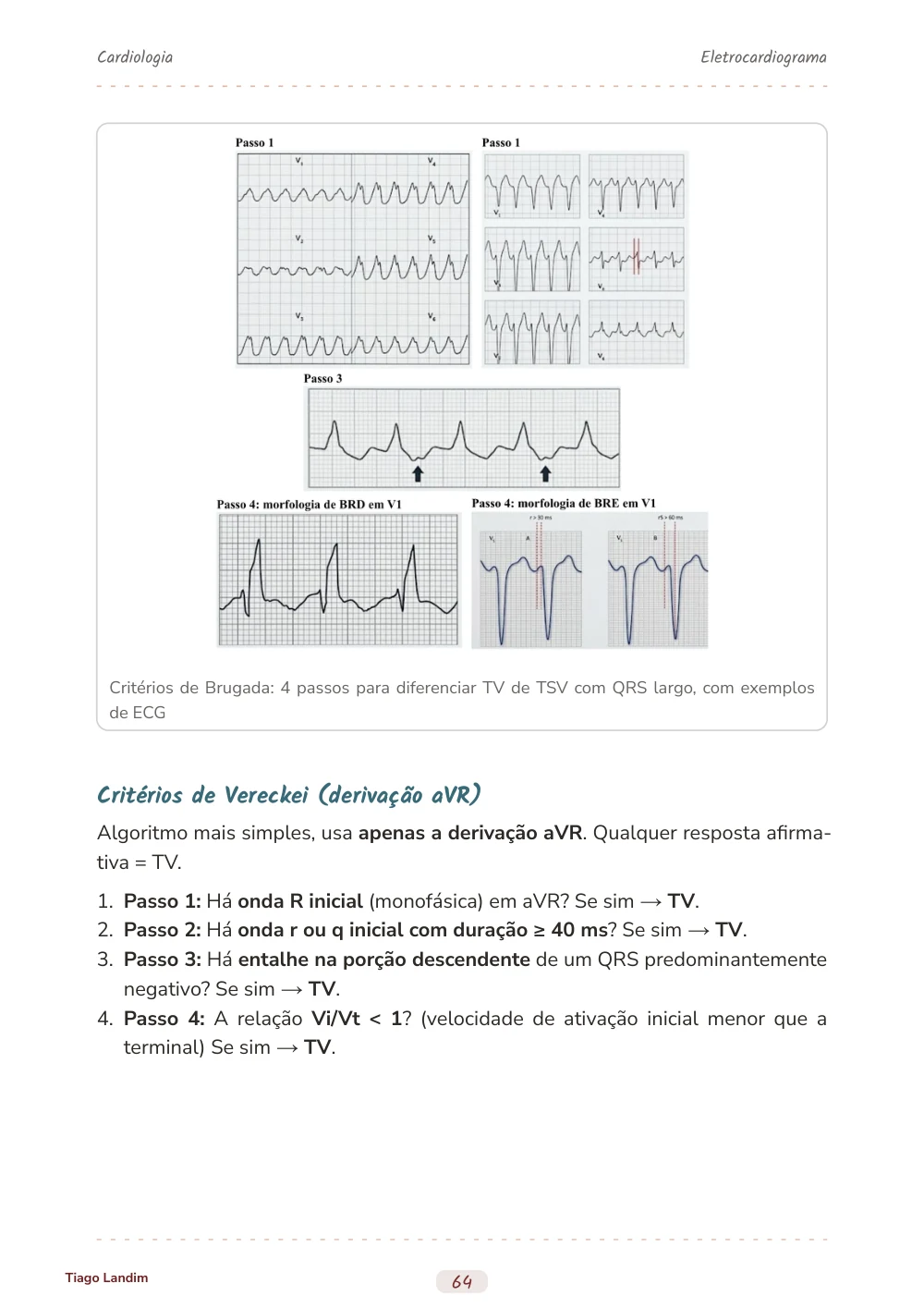 Eletrocardiograma