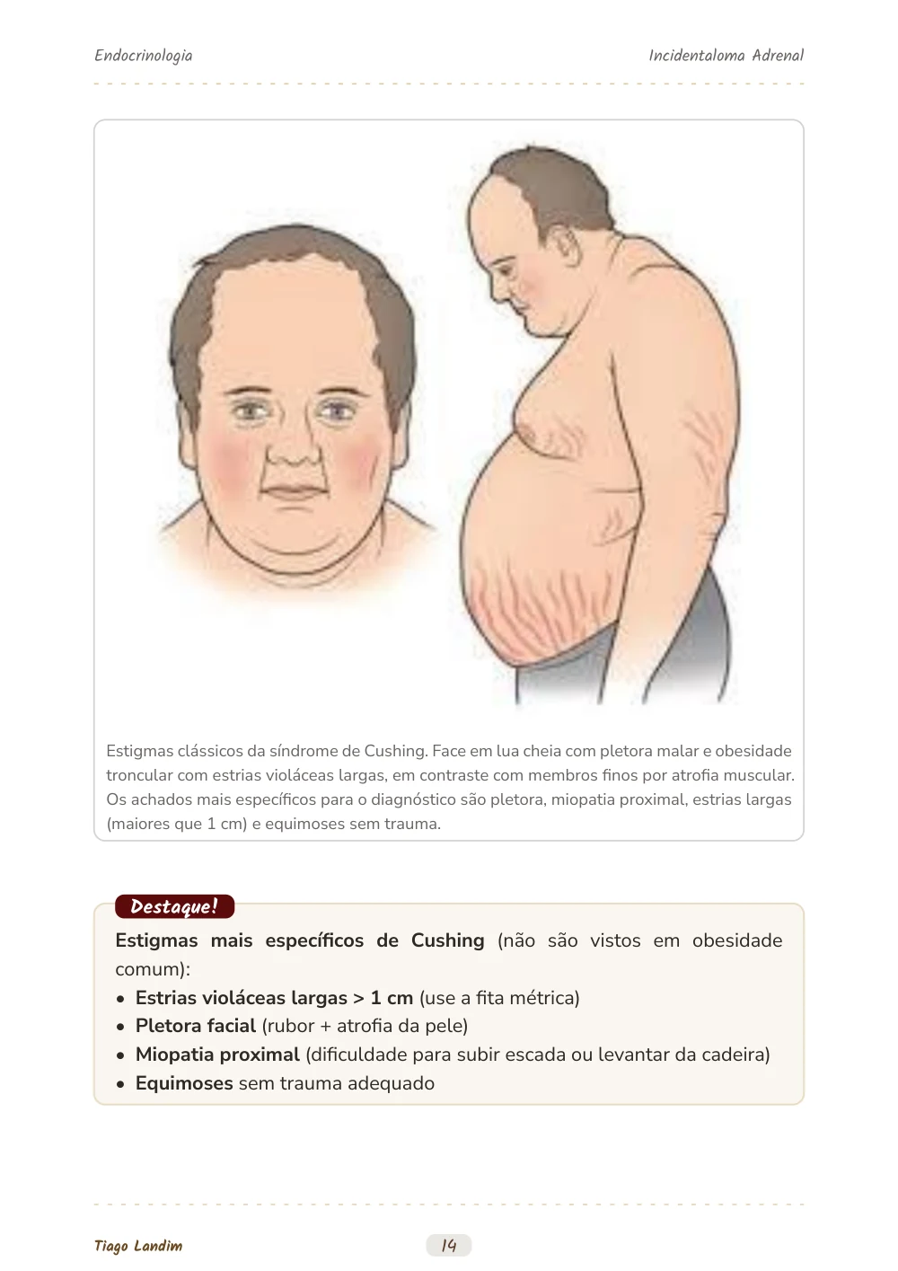 Incidentaloma Adrenal