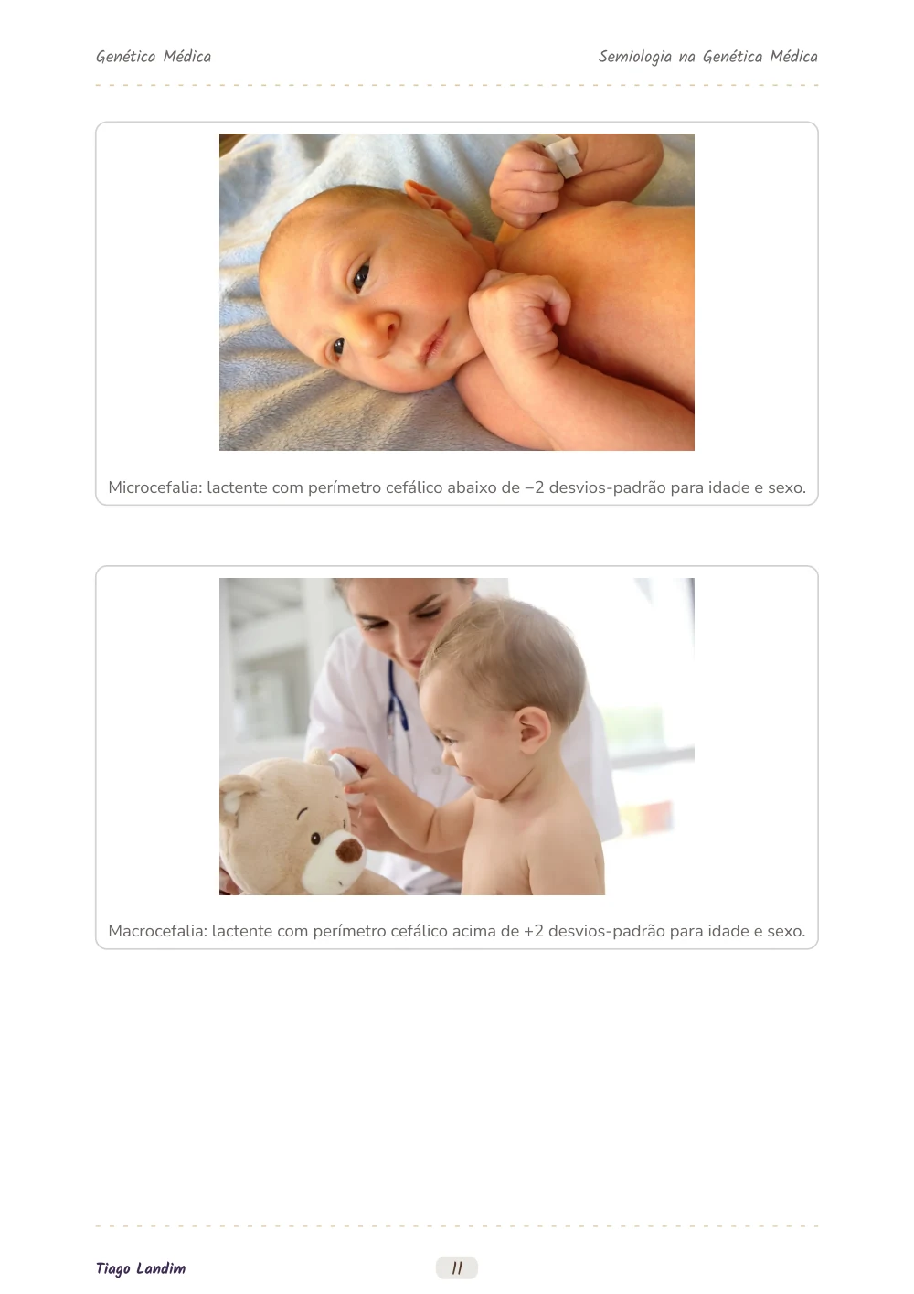 Semiologia na Genética Médica