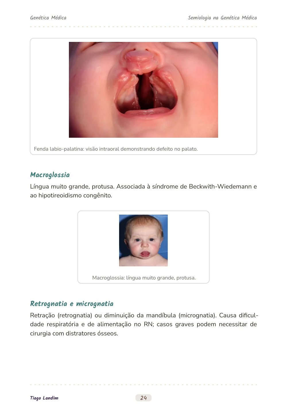 Semiologia na Genética Médica