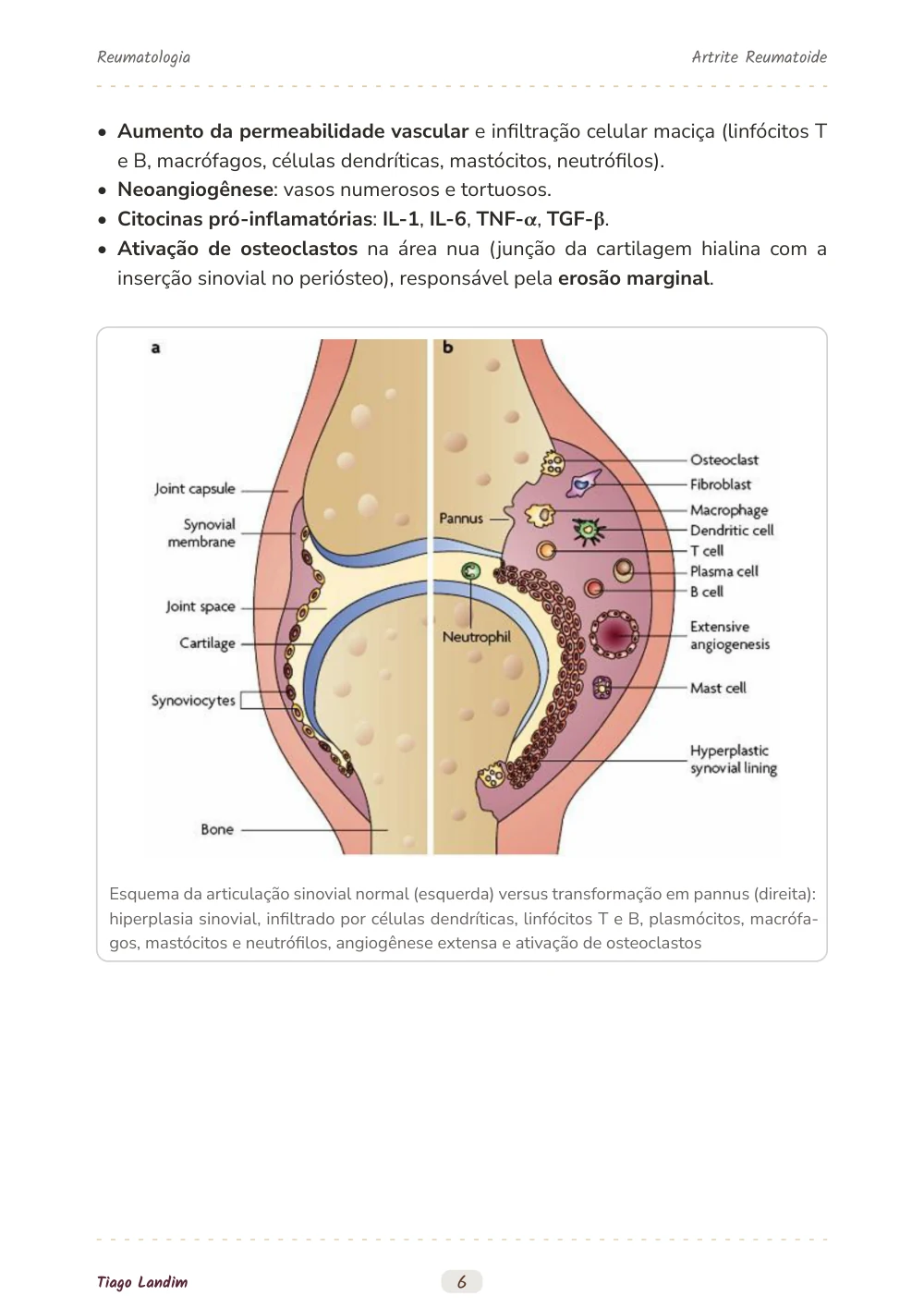 Artrite Reumatoide