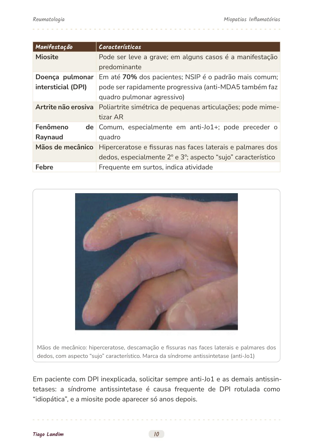 Miopatias Inflamatórias
