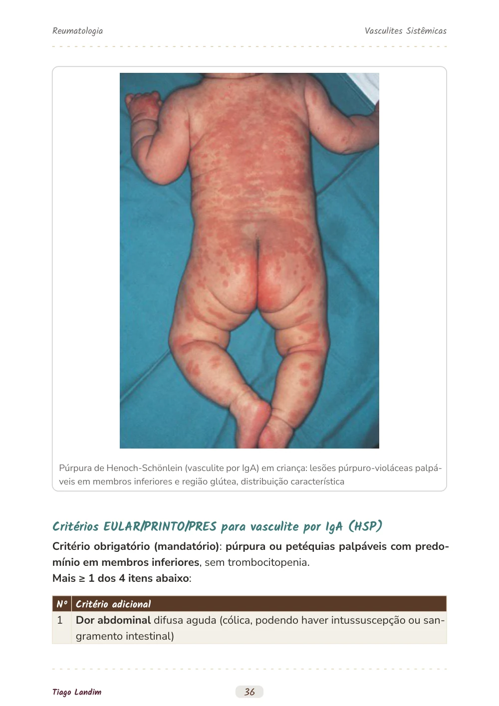Vasculites Sistêmicas
