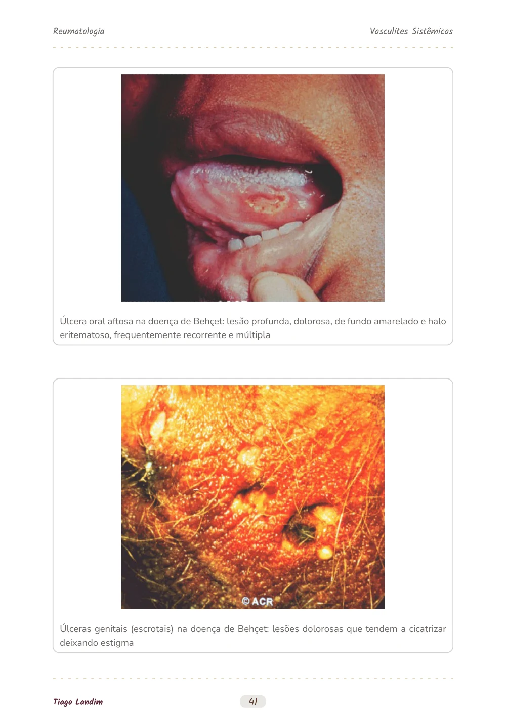 Vasculites Sistêmicas