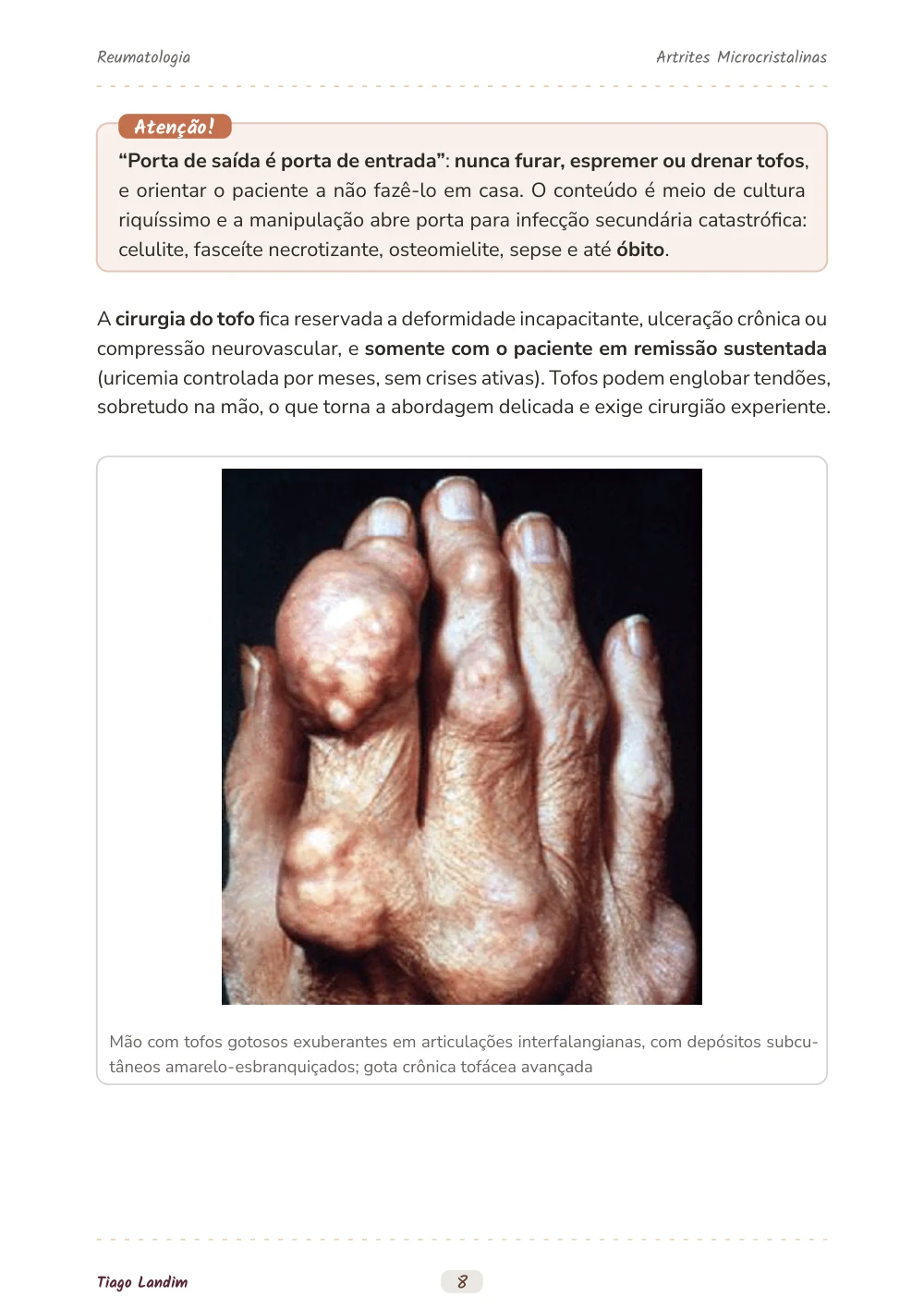 Artrites Microcristalinas