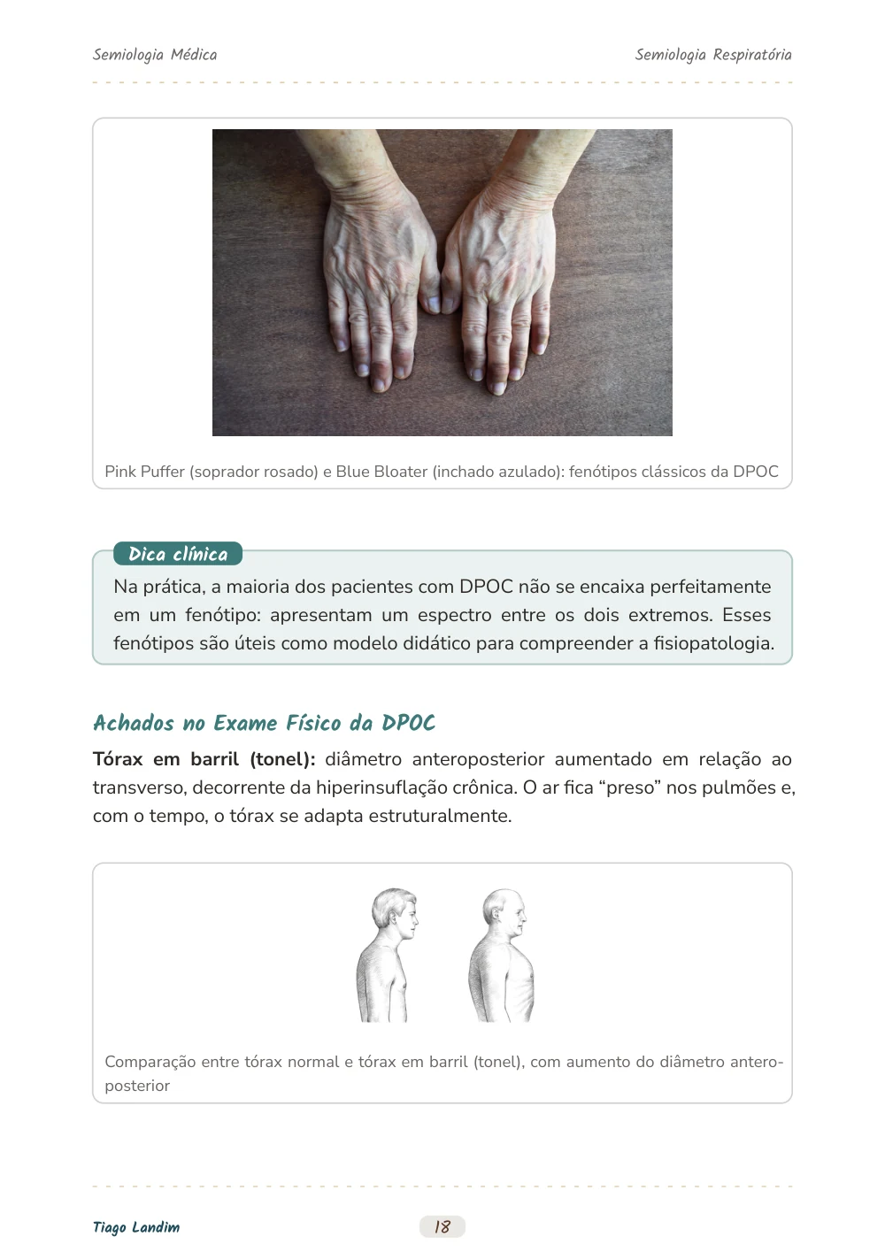 Semiologia Respiratória