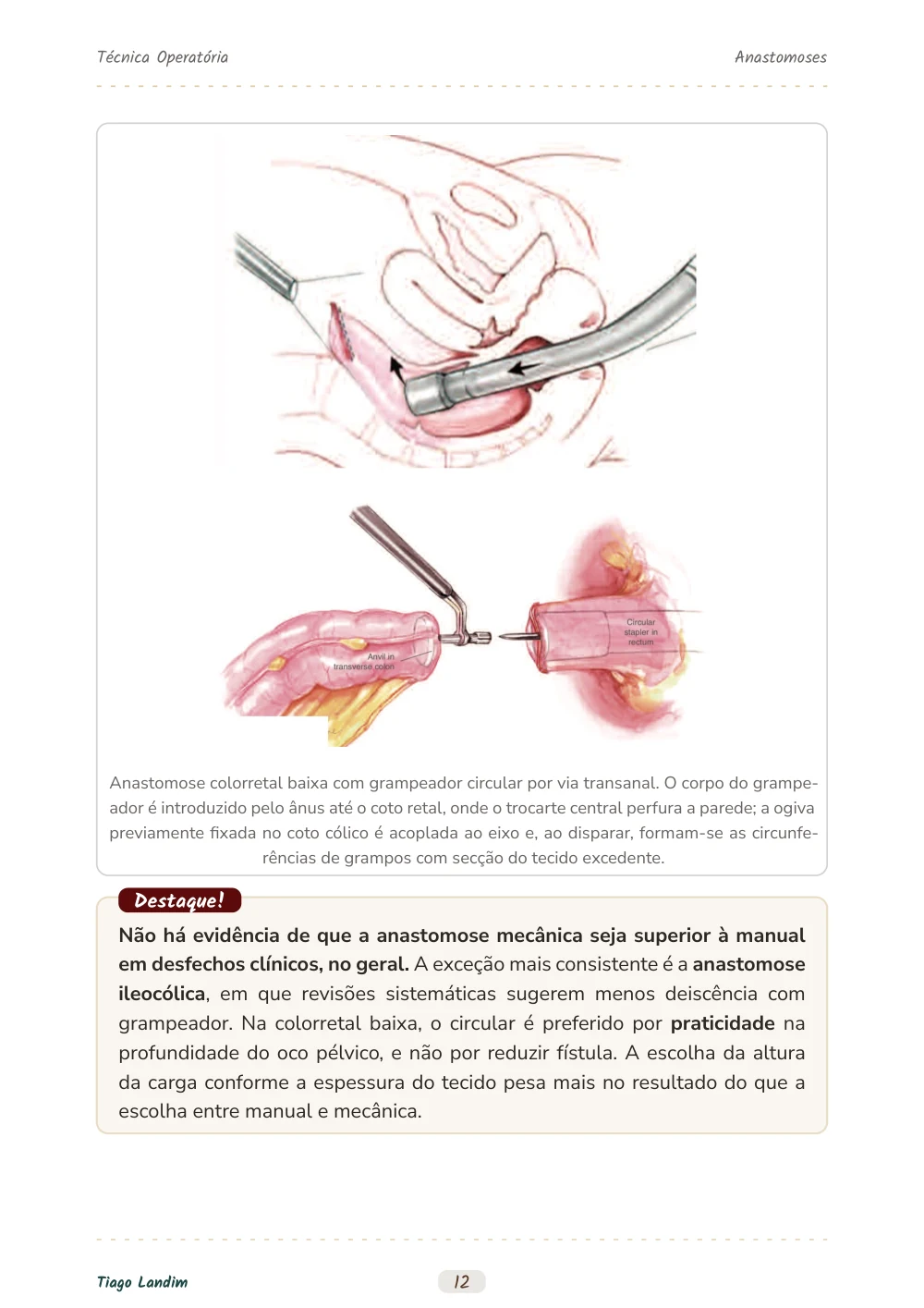 Anastomoses