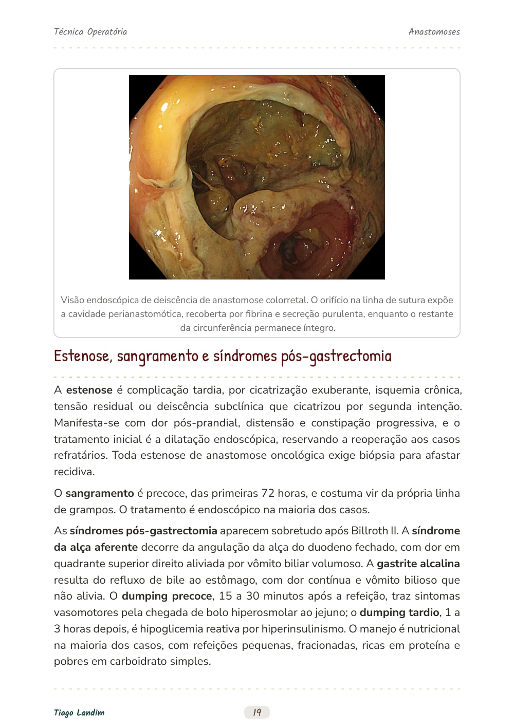 Anastomoses