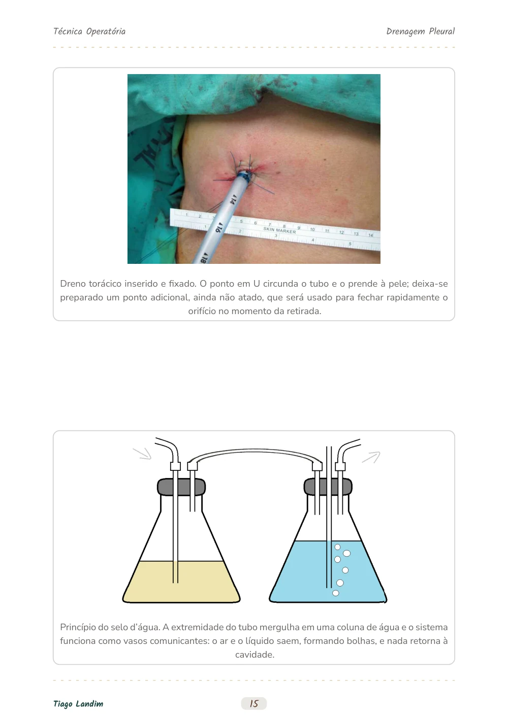 Drenagem Pleural